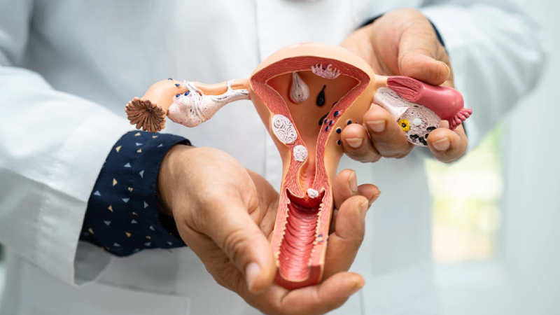 Her 10 kadından 1’i risk altında: Polikistik over sendromu belirtilerine dikkat!